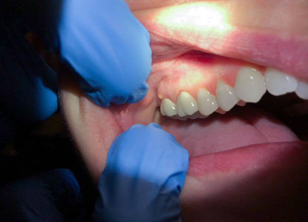 Best After-Hours Emergency Dentist in Barrington Hls, IL