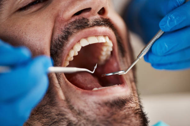 Best Emergency Dental Surgery in Barrington Hls, IL
