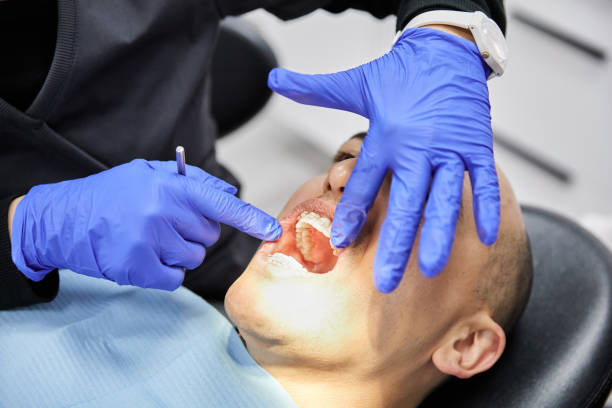 Best Emergency Wisdom Teeth Removal in Barrington Hls, IL
