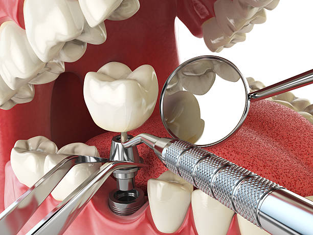 Best Walk-In Emergency Dentist in Barrington Hls, IL